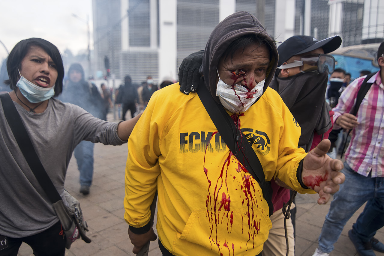 La violencia de las FF. AA armadas ecuatorianas dejan varios heridos y personas que perdieron uno de sus ojos.
